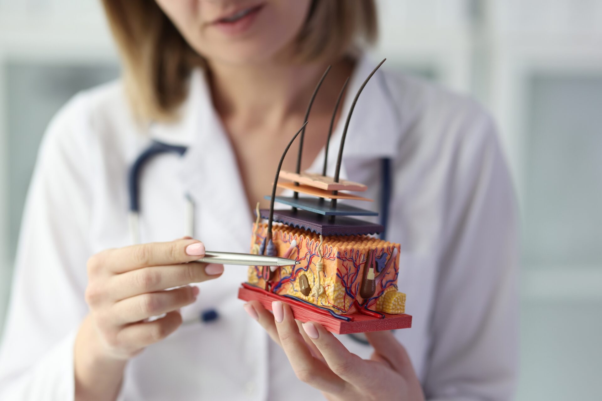 Close-up of female dermatologist holding artificial model of human skin with hair. Doctor showing skin diseases and hair loss symptoms